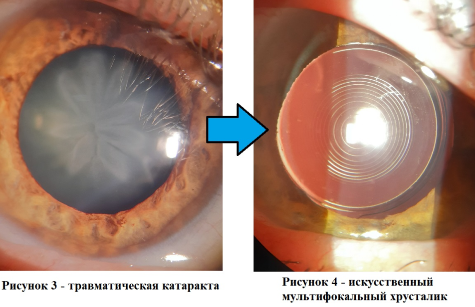 рис3,4.png
